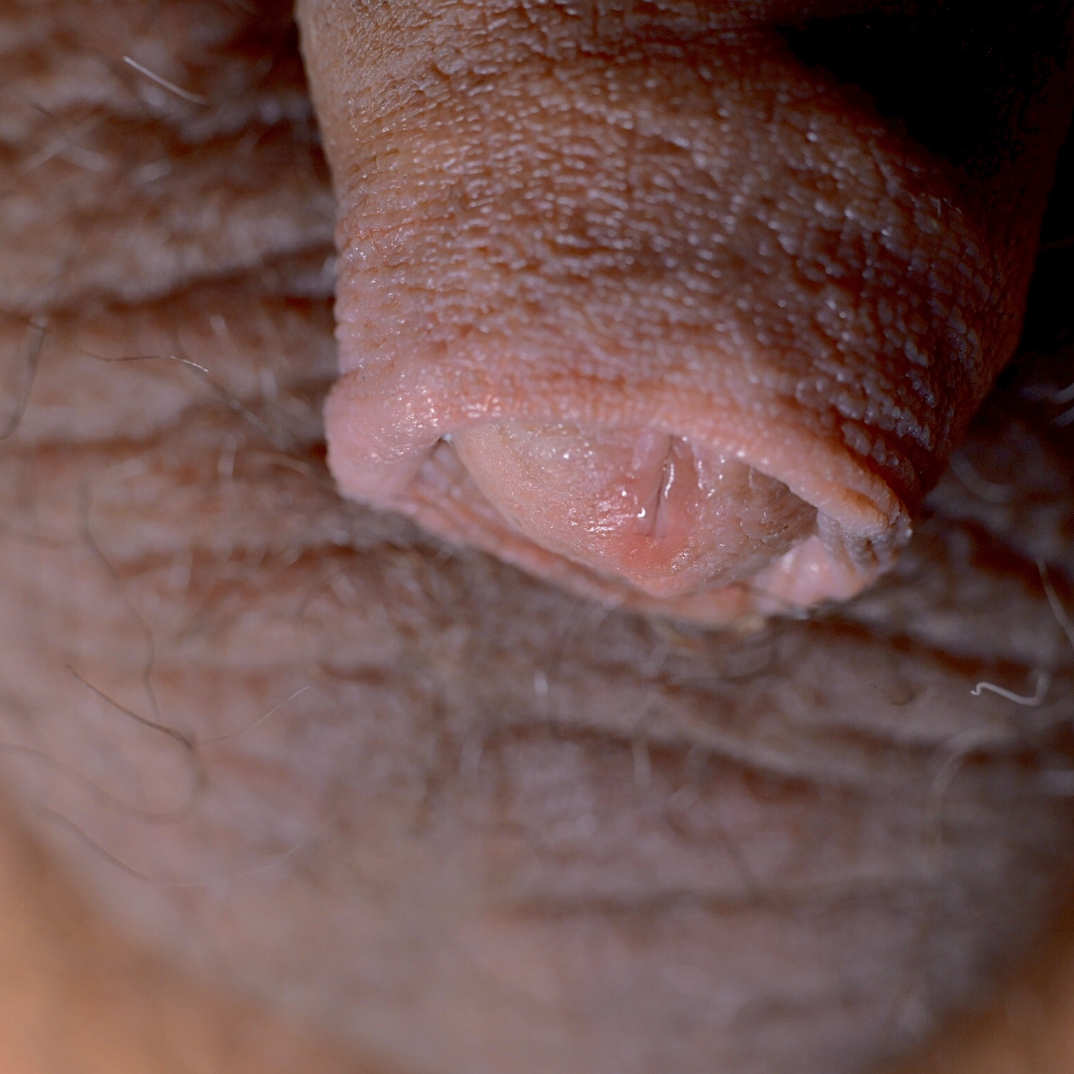 playing with my foreskin — 31