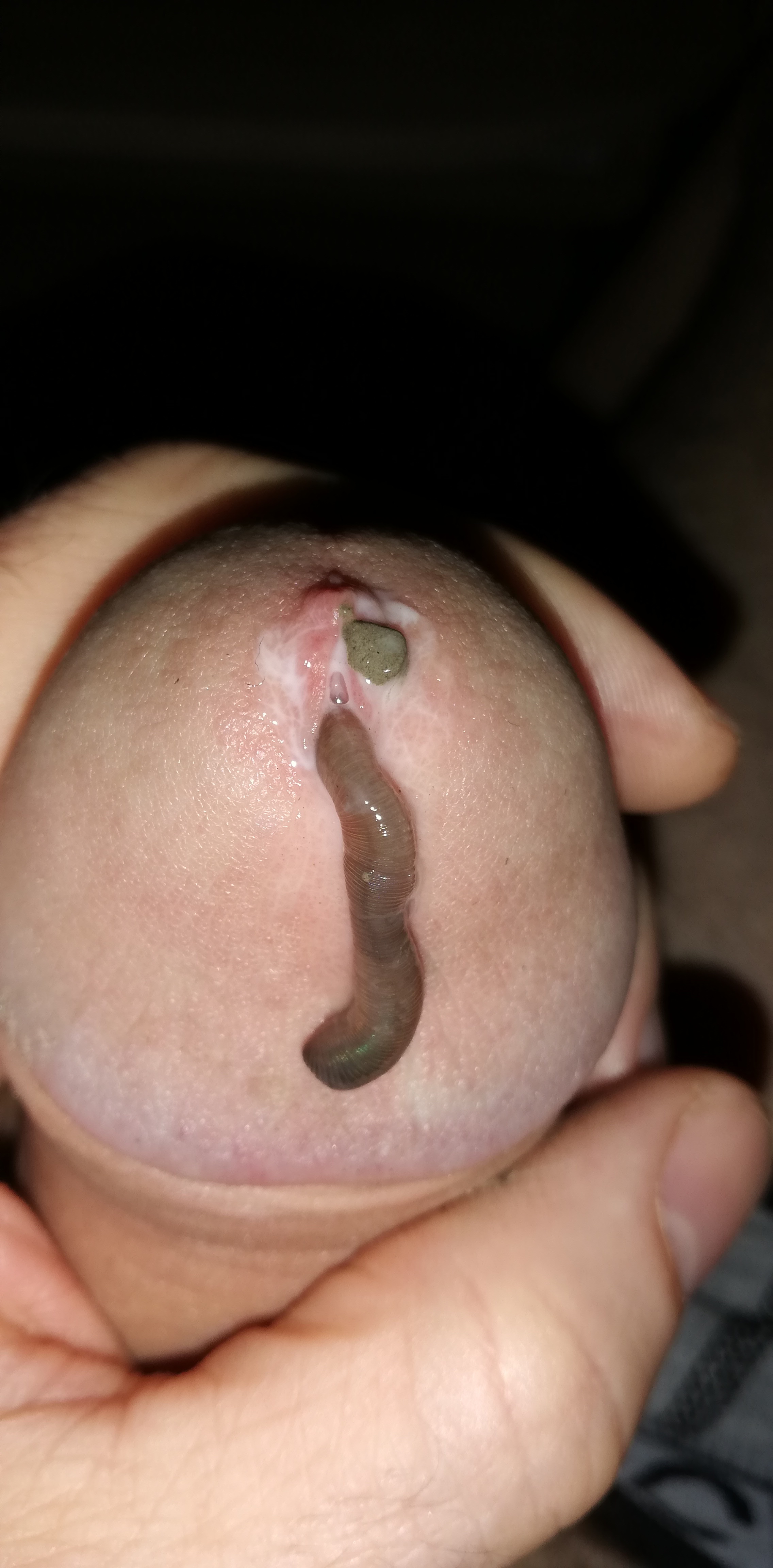 Game with worm — 13