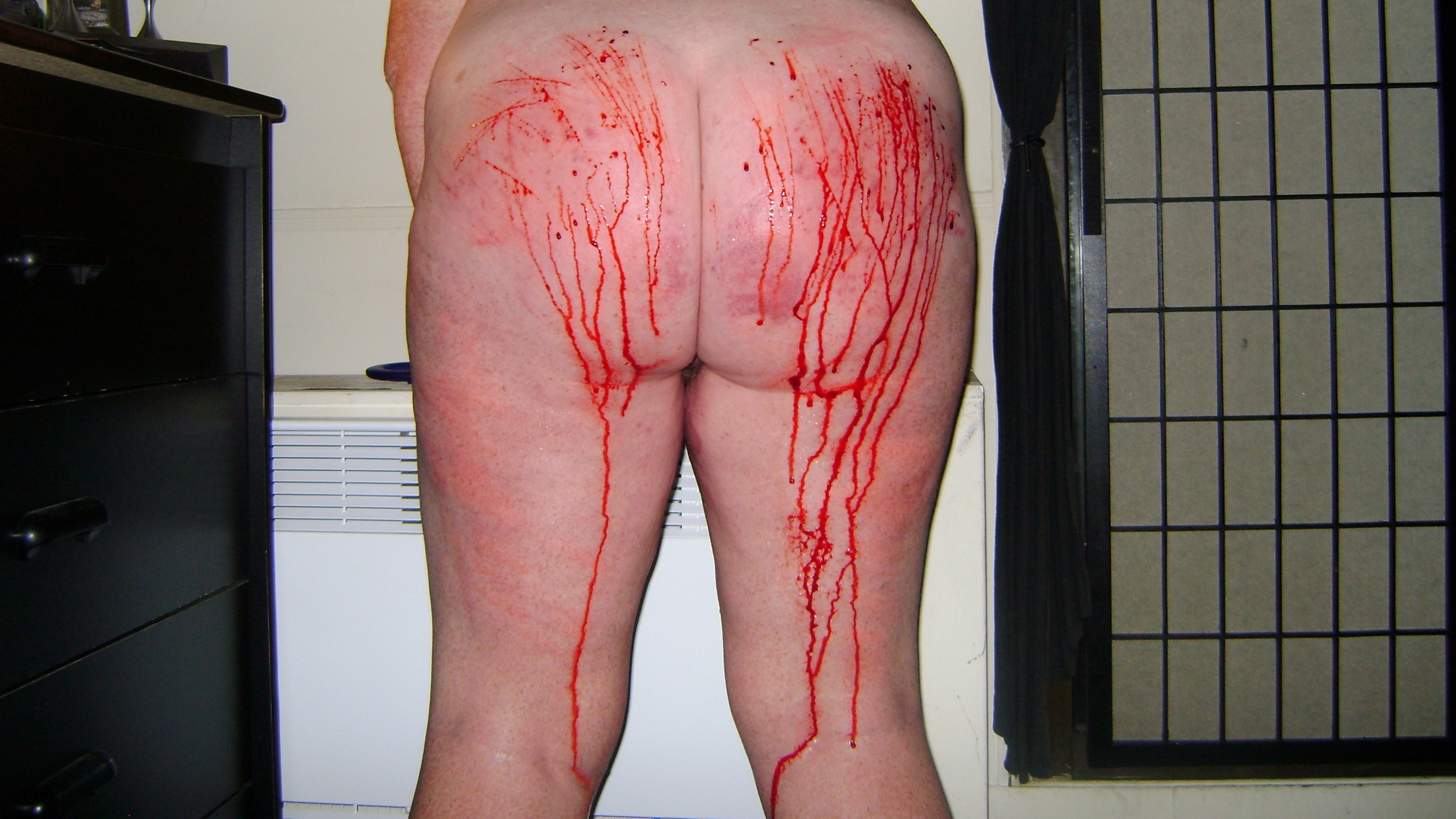 Cutting BBW Slave's Bleeding Ass and Bloody Tits — 9